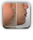사진으로보는 치료증례