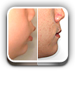 사진으로보는 치료증례